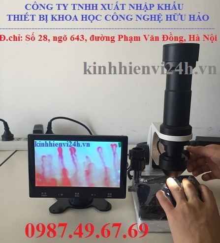Kính hiển vi soi tĩnh mạch