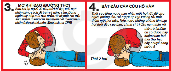 Các kỹ thuật chi tiết trong CPR