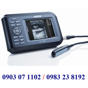 Máy siêu âm thai động vật Model:HAND SCAN V8
