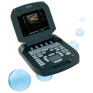 Máy siêu âm xách tay màu