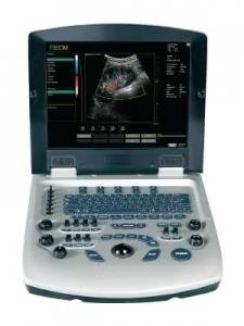 Máy siêu âm xách tay màu 4D