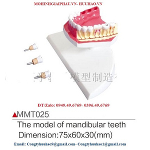 Mô hình răng hàm dưới