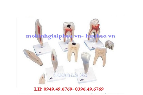 Mô hình 5 loại răng