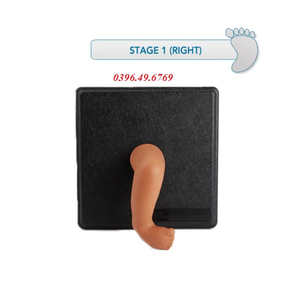 MÔ HÌNH BÀN CHÂN KHOÈO