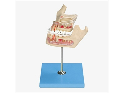 Mô hình bệnh lý của răng và hàm