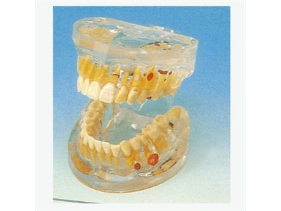 Mô hình bệnh lý nha khoa trong suốt