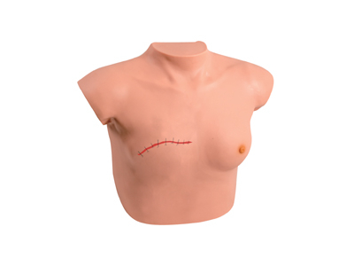 Mô hình chăm sóc sau phẫu thuật tuyến vú