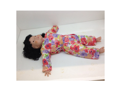 Mô hình chăm sóc trẻ mắc hội chứng Downs