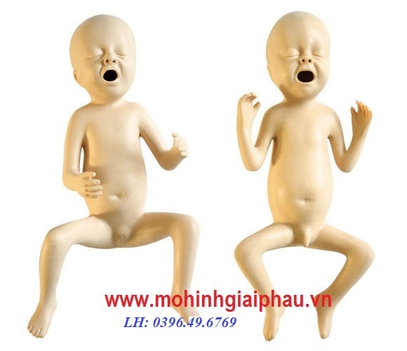 Mô hình chăm sóc trẻ sơ sinh thiếu tháng