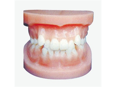 Mô hình chỉnh nha