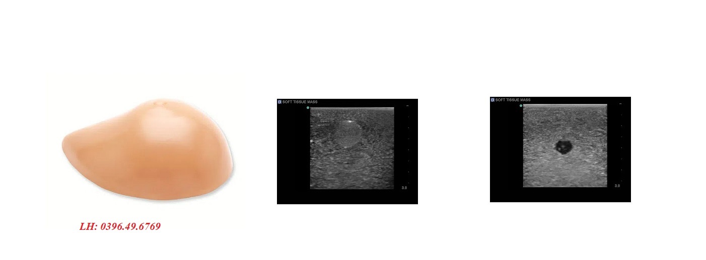 Mô hình đào tạo siêu âm và chọc dò vú