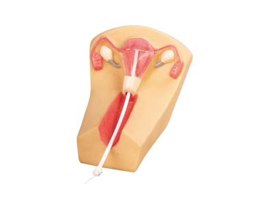 Mô hình đặt dụng cụ tránh thai nữ giới