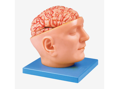 Mô hình động mạch não