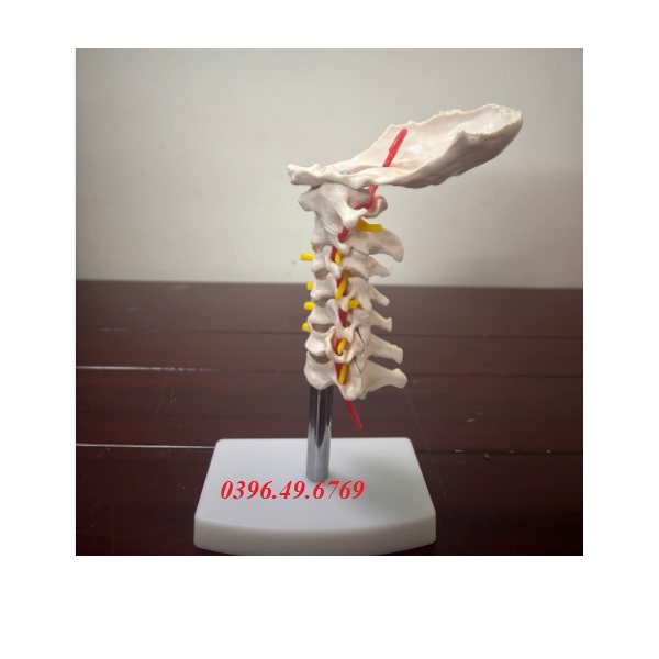 MÔ HÌNH ĐỐT SỐNG THẮT LƯNG CÓ XƯƠNG CÙNG, XƯƠNG CÙNG, VÀ THOÁT VỊ ĐĨA ĐỆM