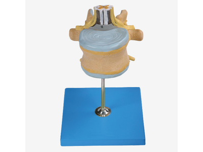 Mô hình đốt sống thắt lưng với tủy sống và dây thần kinh Cauda Equina