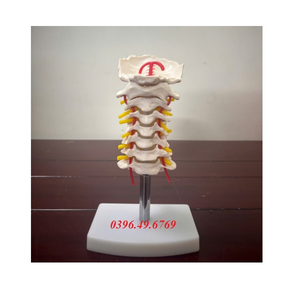 Mô hình đốt sống thắt lưng với xương cùng xương cụt và thoát vị đĩa đệm