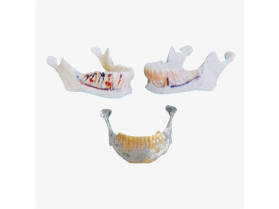 Mô hình giải phẫu hàm dưới