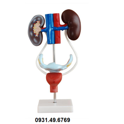 MÔ HÌNH GIẢI PHẪU HỆ TIẾT NIỆU NỮ