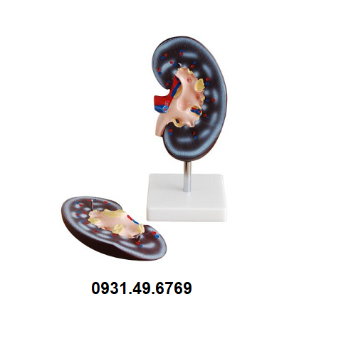MÔ HÌNH GIẢI PHẪU THẬN 2 PHẦN