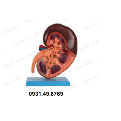 MÔ HÌNH GIẢI PHẪU THẬN HONGLIAN GD/A14005