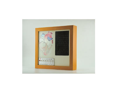 Mô hình hệ thống dẫn truyền điện tim