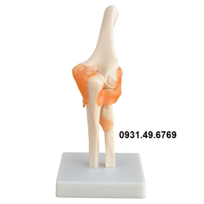 MÔ HÌNH KHỚP KHUỶU TAY