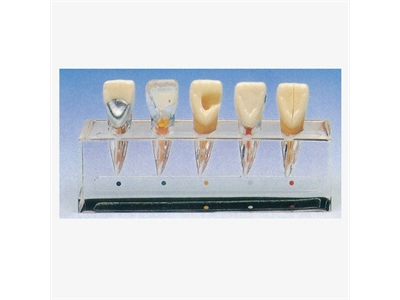 Mô hình lâm sàng về nội nha