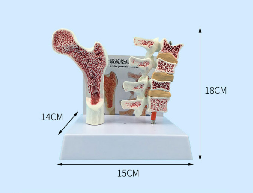 Mô hình loãng xương