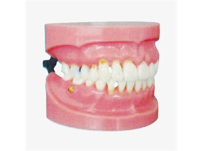 Mô hình mô phỏng bệnh nha chu