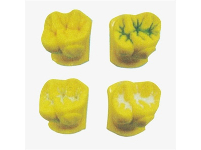 Mô hình mô phỏng quá trình trám khe nứt