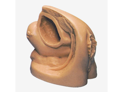 Mô hình mô phỏng thông niệu đạo nữ