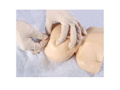 Mô hình mô phỏng tĩnh mạch da đầu ở trẻ sơ sinh