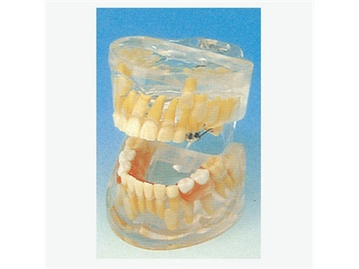 Mô hình phát triển răng sữa trong suốt