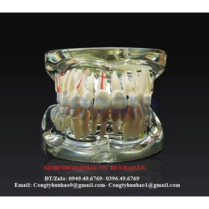 Mô hình hàm răng 3D trong suốt