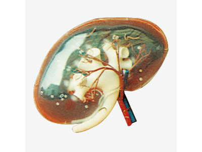 Mô hình thận trong suốt