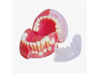 Mô hình thay răng sơ cấp 3 tuổi và răng vĩnh viễn