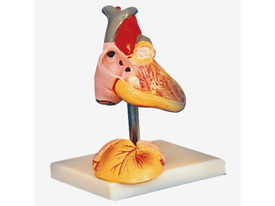 Mô hình tim trẻ em