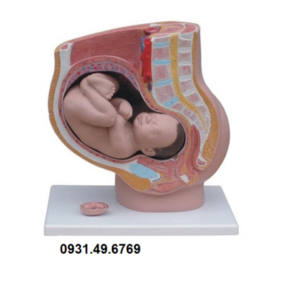 MÔ HÌNH XƯƠNG CHẬU NỮ VÀ THAI NHI ĐỦ THÁNG