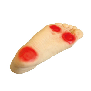 Mô phỏng chăm sóc bàn chân cho bệnh nhân tiểu đường