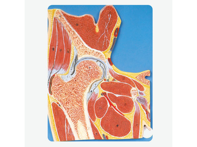 Mô hình khớp hông