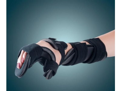 Nẹp chỉnh hình gãy bàn tay