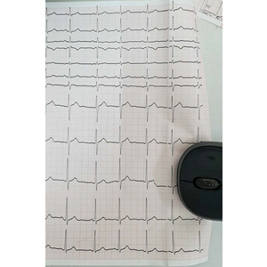 Giấy điện tim Nihon Koden RQS 210-3 (210x30)