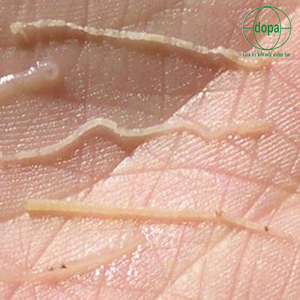 🔴Phòng và điều trị bệnh phân trắng trên tôm