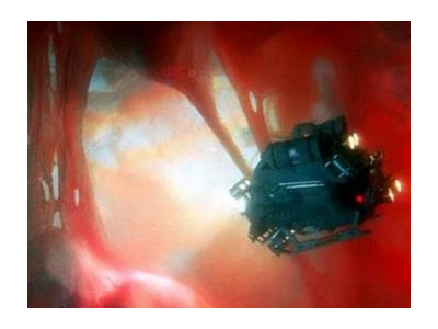 Robot siêu nhỏ tìm bệnh