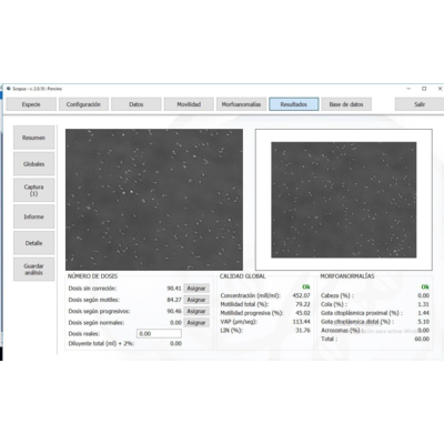 Hệ thống phân tích tinh trùng Model: SCOPUS 2.0