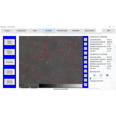 Hệ thống phân tích tinh trùng Model: SCOPUS 2.0