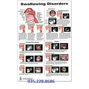 Tranh miệng họng SWALLOWING DISORDERS