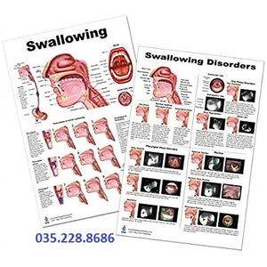 Tranh miệng họng SWALLOWING DISORDERS