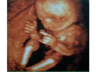 Tìm hiểu nguyên lý của máy siêu âm