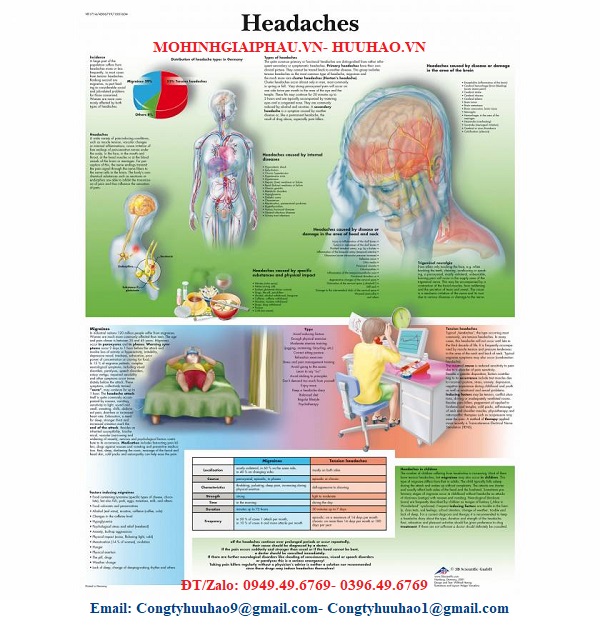 TRANH, BIỂU ĐỒ BỆNH ĐAU ĐẦU